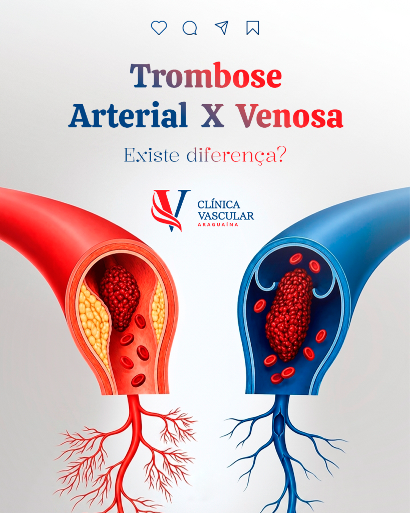 Carrossel para Clínica Vascular Araguaína